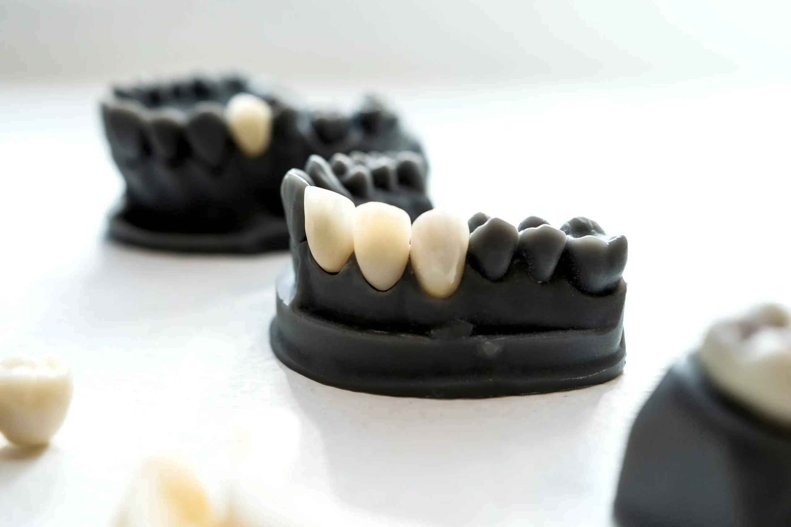 Puentes dentales de zirconio duraderos