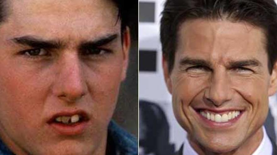 Tom cruise diseño de sonrisa